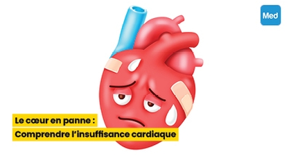 Le cœur en panne : Comprendre l'insuffisance cardiaque