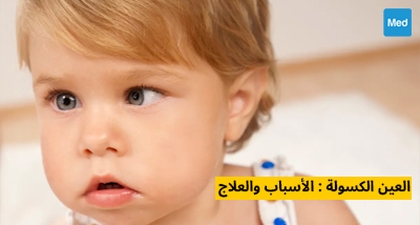 العين الكسولة : الأسباب والعلاج