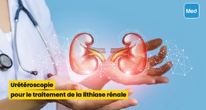 Urétéroscopie pour le traitement de la lithiase rénale