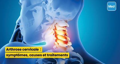 Arthrose cervicale : symptômes, causes et traitements