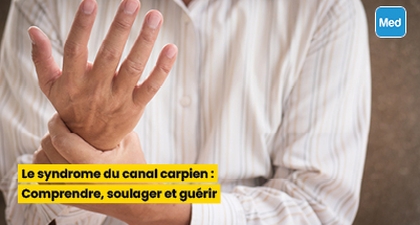 Le syndrome du canal carpien : Comprendre, soulager et guérir