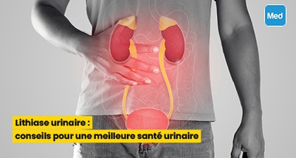 Lithiase urinaire : conseils pour une meilleure santé urinaire