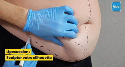Liposuccion : Sculpter votre silhouette
