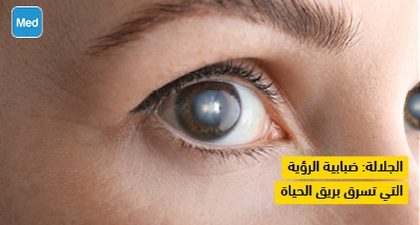 الجلالة: ضبابية الرؤية التي تسرق بريق الحياة