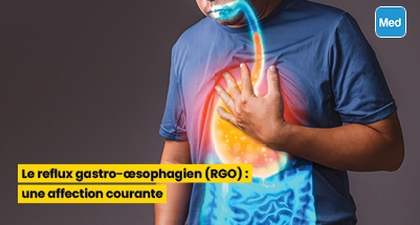 Le reflux gastro-œsophagien (RGO) : une affection courante