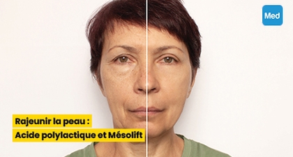Rajeunir la peau : Acide polylactique et Mésolift