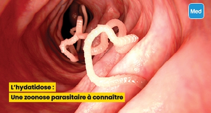 L'hydatidose : Une zoonose parasitaire à connaître