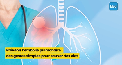 Prévenir l'embolie pulmonaire : des gestes simples pour sauver des vies