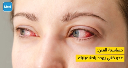 حساسية العين: عدو خفي يهدد راحة عينيك