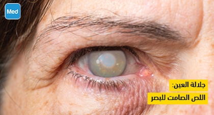 جلالة العين: اللص الصامت للبصر