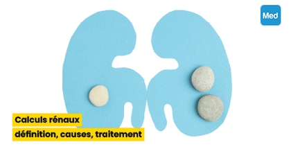 Calculs rénaux : définition, causes, traitement