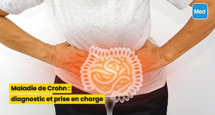 Maladie de Crohn : diagnostic et prise en charge
