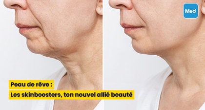 Peau de rêve : Les skinboosters, ton nouvel allié beauté
