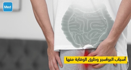 أسباب البواسير وطرق الوقاية منها