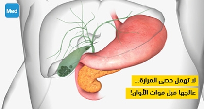 لا تهمل حصى المرارة... عالجها قبل فوات الأوان!