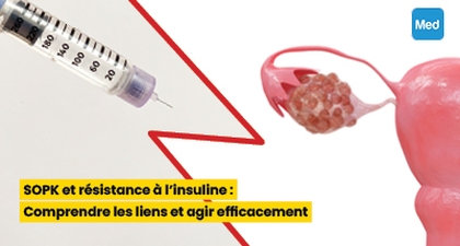 SOPK et résistance à l'insuline : Comprendre les liens et agir efficacement