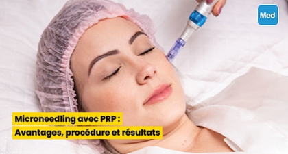 Microneedling avec PRP : Avantages, procédure et résultats