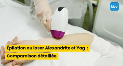 Épilation au laser Alexandrite et Yag : Comparaison détaillée