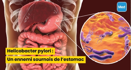 Helicobacter pylori : Un ennemi sournois de l'estomac