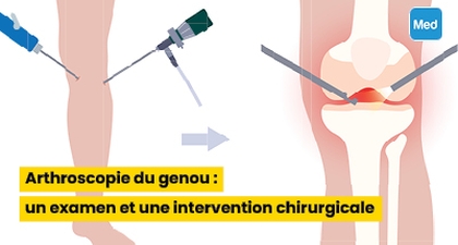 Arthroscopie du genou : un examen et une intervention chirurgicale