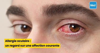 Allergie oculaire : un regard sur une affection courante