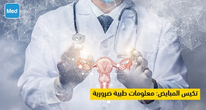 تكيس المبايض: معلومات طبية ضرورية 