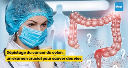Dépistage du cancer du colon : un examen crucial pour sauver des vies