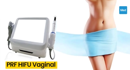 PRF HIFU Vaginal : La Nouvelle Génération de Traitements Gynécologiques