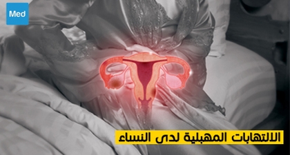 الالتهابات المهبلية لدى النساء