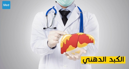 الكبد الدهني