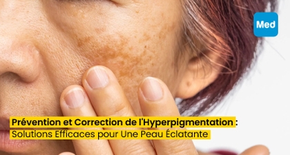 Prévention et Correction de l'Hyperpigmentation : Solutions Efficaces pour Une Peau Éclatante