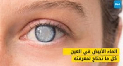 الماء الأبيض: كل ما تحتاج لمعرفته عنه