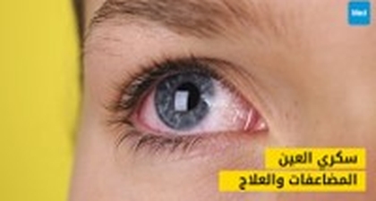 سكري العين: دليلك الشامل لفهم المضاعفات والعلاج
