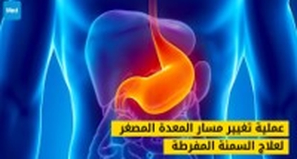 عملية تغيير مسار المعدة المصغر لعلاج السمنة المفرطة