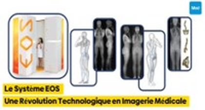 Le Système EOS : Une Révolution Technologique en Imagerie Médicale