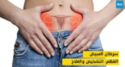 سرطان المبيض: الفهم، التشخيص والعلاج