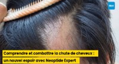 Comprendre et combattre la chute de cheveux : un nouvel espoir avec Neoptide Expert