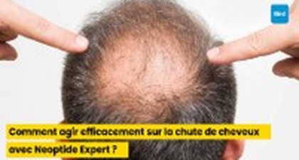 Comment agir efficacement sur la chute de cheveux avec Neoptide Expert ?