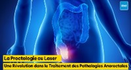 La Proctologie au Laser : Une Révolution dans le Traitement des Pathologies Anorectales
