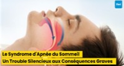 Le Syndrome d'Apnée du Sommeil : Un Trouble Silencieux aux Conséquences Graves