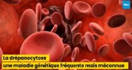 La drépanocytose : une maladie génétique fréquente mais méconnue