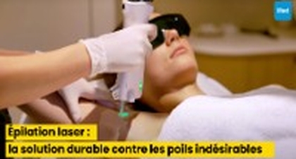 Épilation laser : la solution durable contre les poils indésirables
