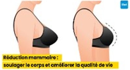Réduction mammaire : soulager le corps et améliorer la qualité de vie