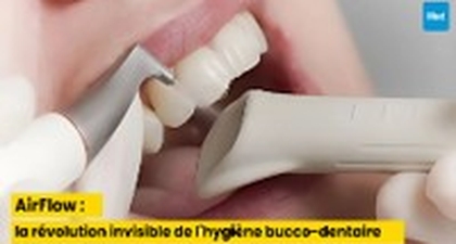 AirFlow : la révolution invisible de l'hygiène bucco-dentaire
