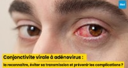 Conjonctivite virale à adénovirus : comment la reconnaître, éviter sa transmission et prévenir les complications ?