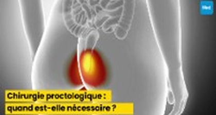 Chirurgie proctologique : quand est-elle nécessaire ?