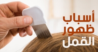 أسباب ظهور القمل