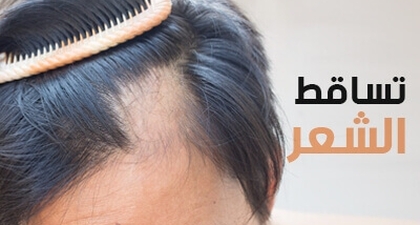 تساقط الشعر 