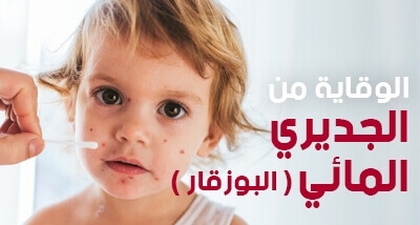  الوقاية من الجديري المائي ( البوزقار )