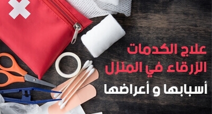 علاج الكدمات الزرقاء في المنزل .. وأسبابها وأعراضها